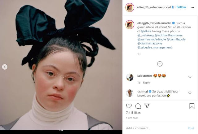 Groundbreaking model with Down syndrome graces the digital cover of Allure image