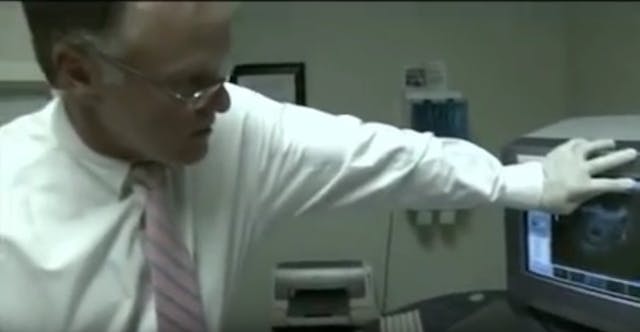 Dr. Terryberry looks for fetal heartbeat Preborn baby girl’s heartbeat went undetected for weeks — then a miracle happened image
