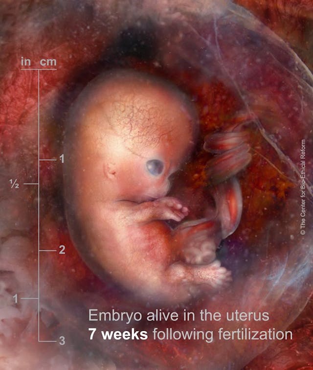 Preborn child, 7 weeks gestation The UN is wrong: These photos prove preborn babies are members of the human family image