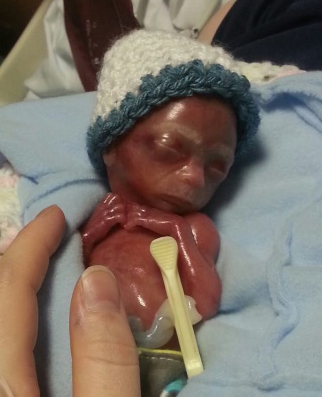 Mother shares powerful photos of baby miscarried at 20 weeks: He was ‘not a clump of cells’ image