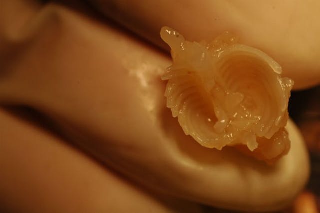 The spinal column and rib cage of an aborted baby, 8 weeks gestation. Photo courtesy of prolifesociety.com and imagesofabortion.com. 6 powerful images that show the reality of abortion in the first trimester image