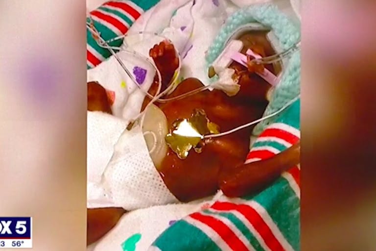 screenshot: Fox5. Jermarius was born at 21 weeks. premature baby