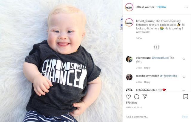 Eli’s parents were told to abort because he would die anyway. He’s now five and thriving. image