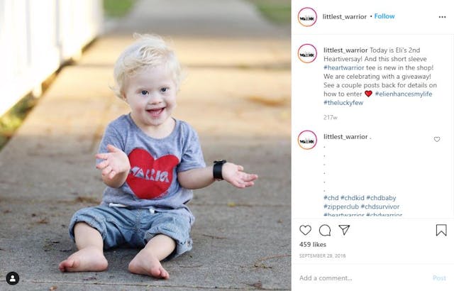 Eli’s parents were told to abort because he would die anyway. He’s now five and thriving. image