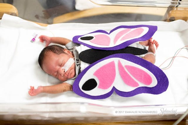 Tiny preemies celebrate their first Halloween with adorable costumes image