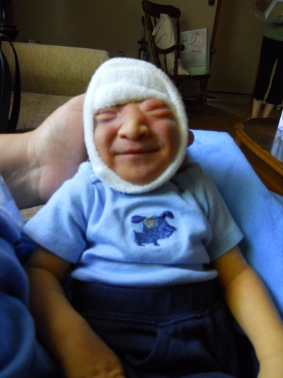 Angela and Gabriel, born with anencephaly, show why every child deserves protection image