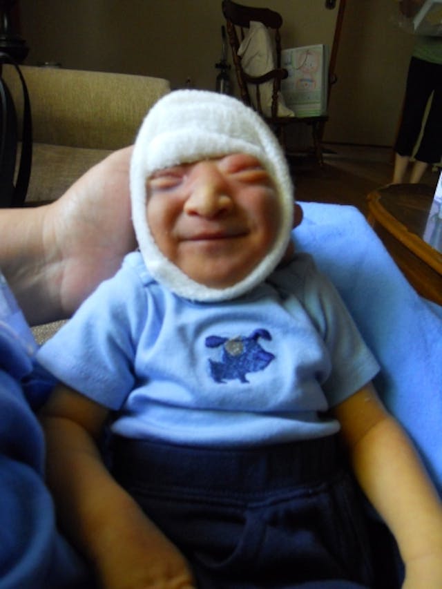 Baby Gabriel lived for 10 days after birth Angela and Gabriel, born with anencephaly, show why every child deserves protection image