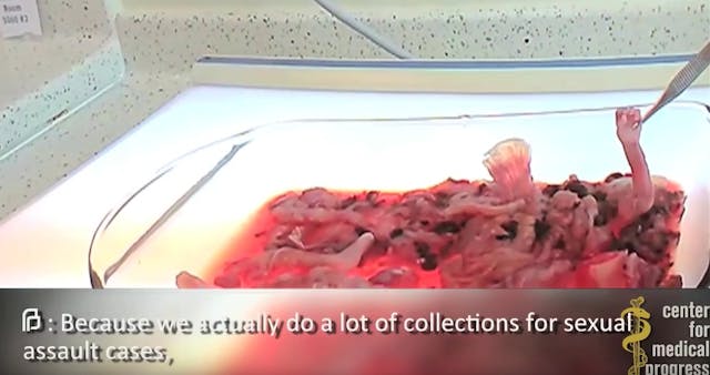 planned-parenthood-baby-arm