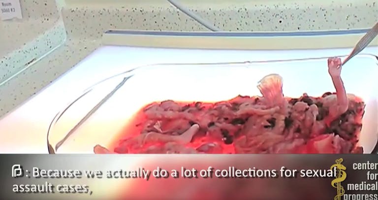 planned-parenthood-baby-arm