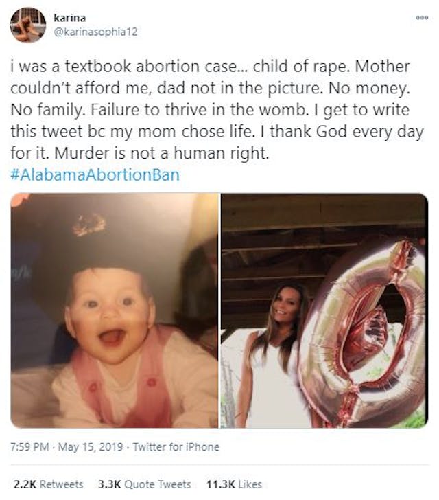 Pro-abortion document, ‘How to Think About the Fetus,’ pits women against babies image