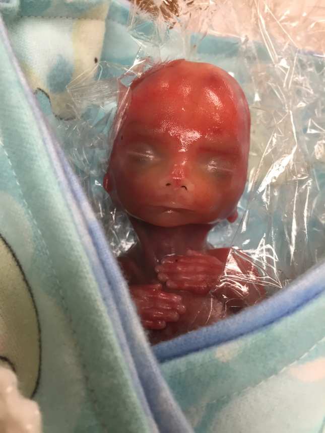 Jaxon Tanner, Charity