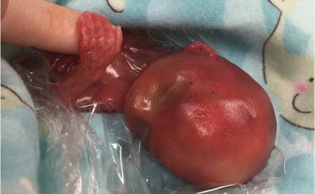 Jaxon Tanner, Charity