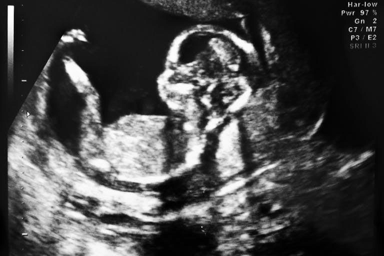 shutterstock_73703938