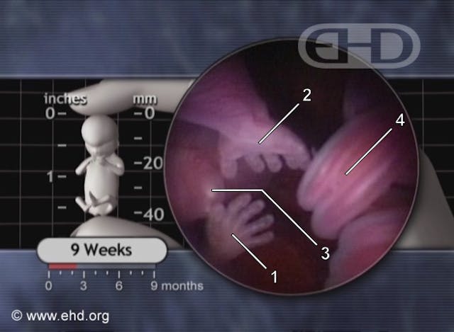 Abortion staff lied about fetal development, refused to show woman her baby’s ultrasound image
