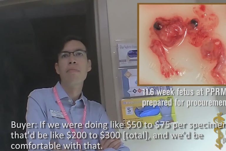 Planned-Parenthood-fetal-parts4