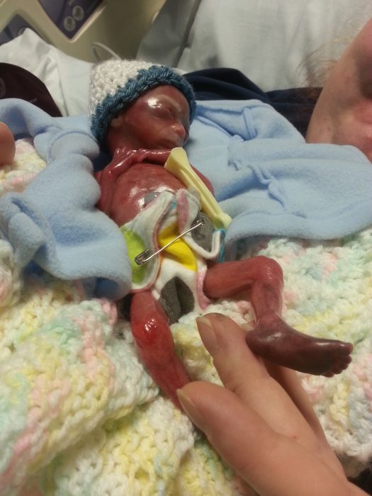 Mother shares powerful photos of baby miscarried at 20 weeks: He was ‘not a clump of cells’ image