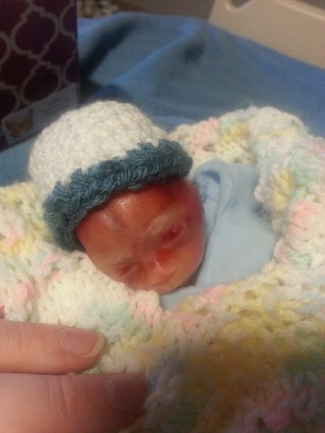 Mother shares powerful photos of baby miscarried at 20 weeks: He was ‘not a clump of cells’ image