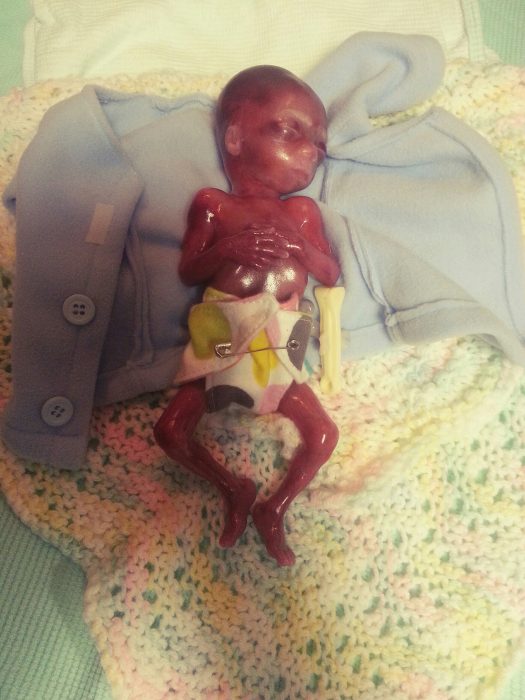 Mother shares powerful photos of baby miscarried at 20 weeks: He was ‘not a clump of cells’ image