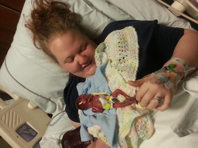 Mother shares powerful photos of baby miscarried at 20 weeks: He was ‘not a clump of cells’ image