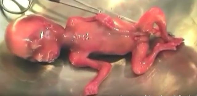The baby Fiorina referenced, from the CMP video.