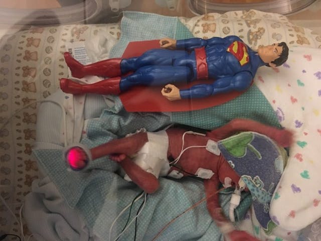 Logan at 2.5 weeks. Photo via Facebook group Prayers for Logan Ray. premature