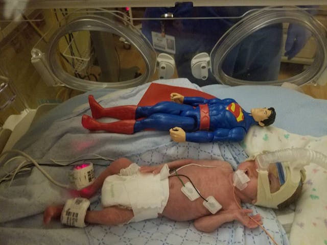 Logan at one month. Photo via Facebook group Prayers for Logan Ray. premature