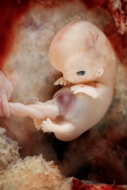 Baby at 7-8 weeks from fertilization