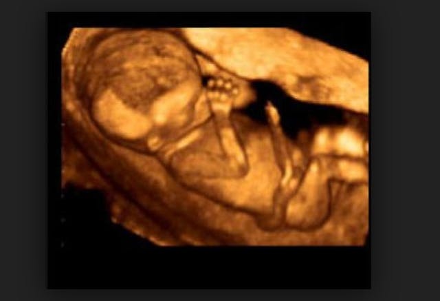 ultrasound, baby, 4d