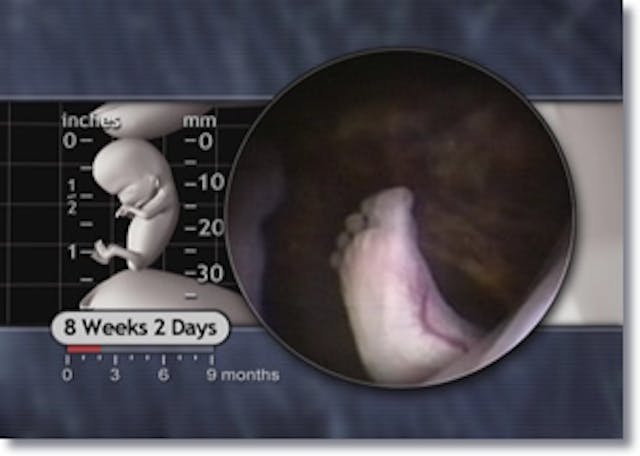 8wks2d-foot