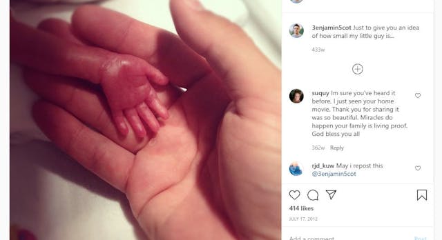 preemie