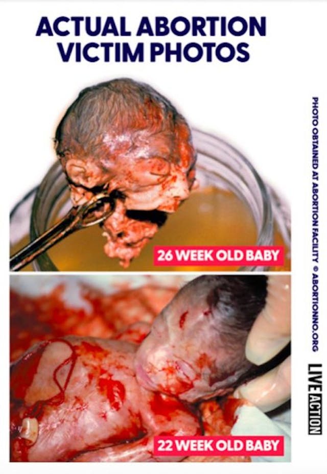 Abortion victims Do Coloradans know the evil they voted to continue? image