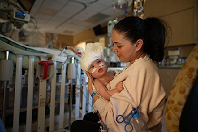 Conjoined twins in the PICU after their separation surgery. Photo: UC Davis Children’s Hospital.