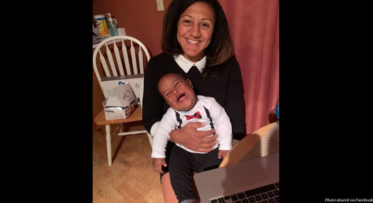 Down syndrome