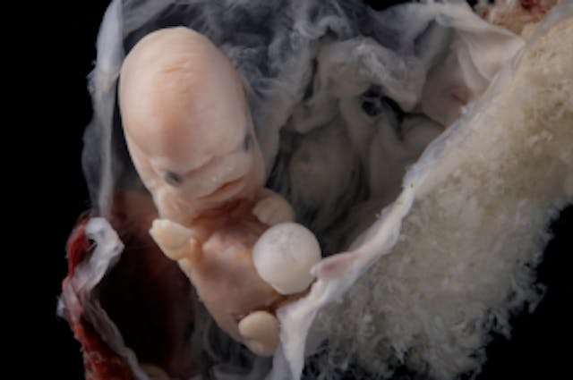 Kentucky abortion patient describes abortion in facility’s basement: ‘It shames you’ image