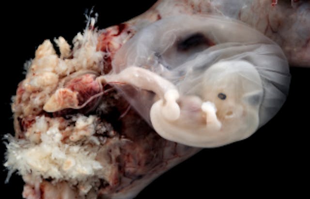 6-7 weeks Kentucky abortion patient describes abortion in facility’s basement: ‘It shames you’ image