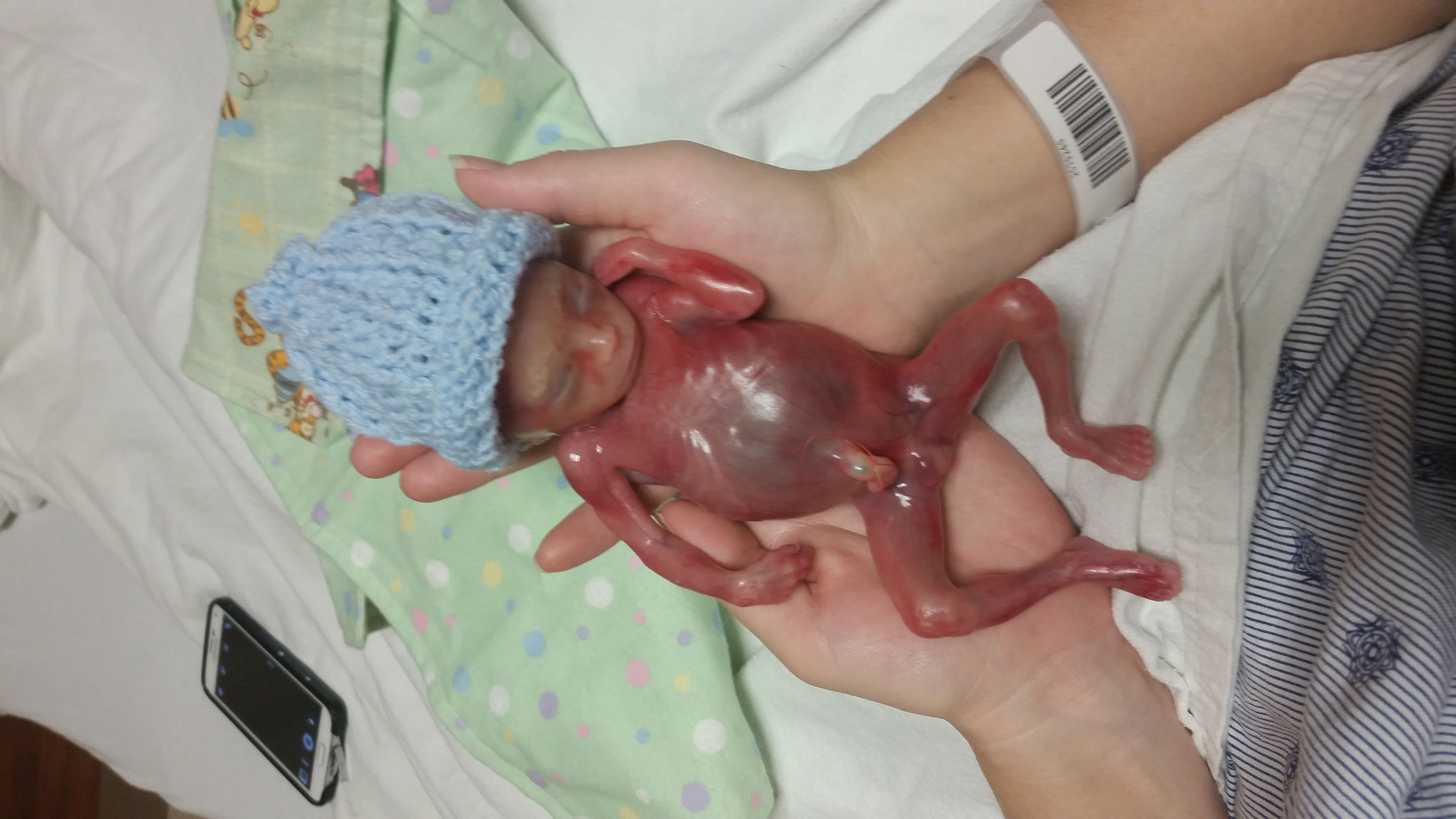 20150816_013044 Greyson