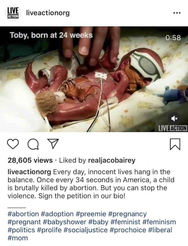 7 things Big Tech has done to suppress Live Action’s pro-life message image