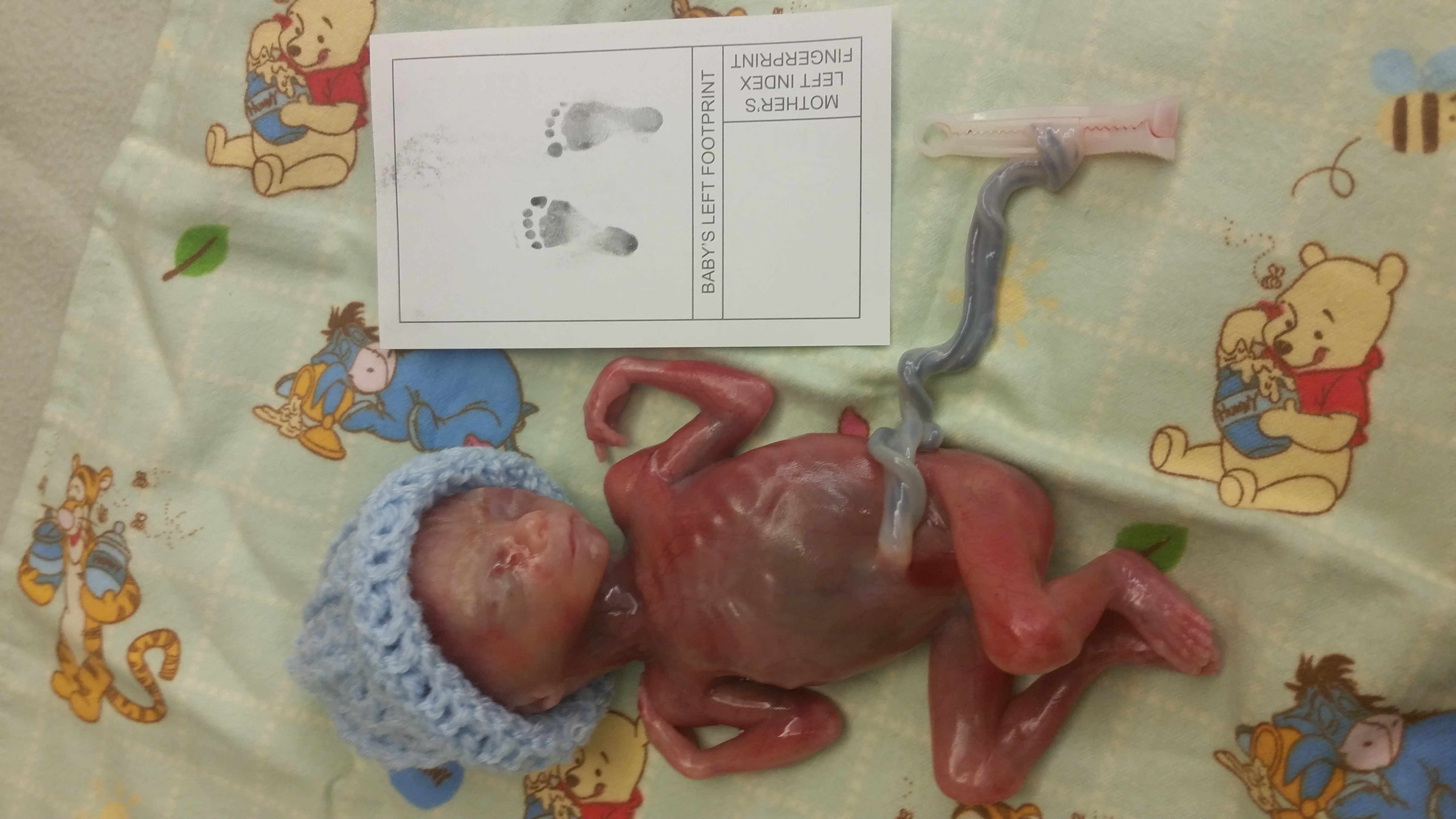 20150816_011307 Greyson