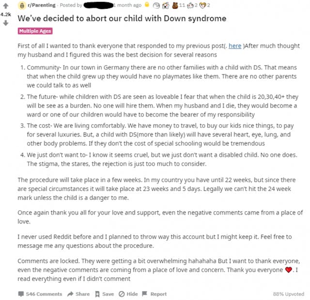 Heartbreaking: Parents balk as sibling asks for funeral for aborted sibling with Down syndrome image