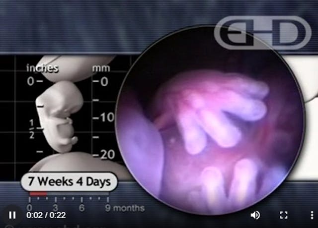 EHD: 7 weeks 4 days after fertilization EHD: 7 weeks 4 days after fertilization