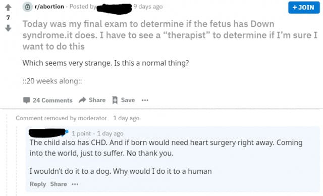 Heartbreaking: Parents balk as sibling asks for funeral for aborted sibling with Down syndrome image