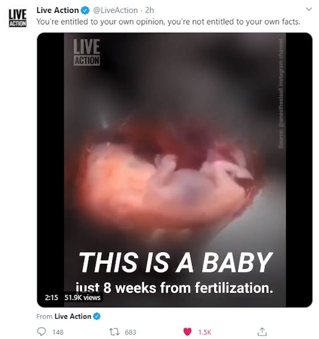 Live Action tweet on 2020 VP Debate facts and abortion (Image: Twitter) Image: Live Action tweet on 2020 VP Debate facts and abortion (Image: Twitter)
