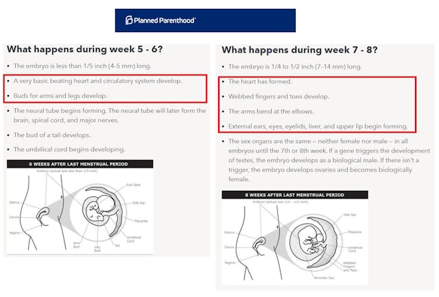 Image: Planned Parenthood fetal development website