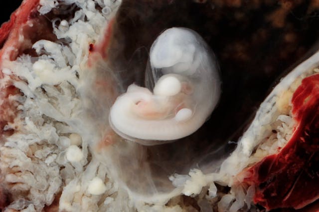 Human embryo with possible heart bulge at 3-4 weeks