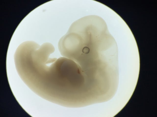 7-week human embryo