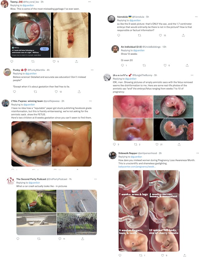 Responding to misinformation by Guardian on abortion and fetal images (Images: Twitter) Image: Responding to misinformation by Guardian on abortion and fetal images (Images: Twitter)