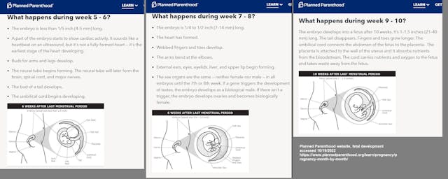 Planned Parenthood fetal development website weeks 5 to 10, accessed 10/19/2022 Image: Planned Parenthood fetal development website weeks 5 to 10, accessed 10/19/2022