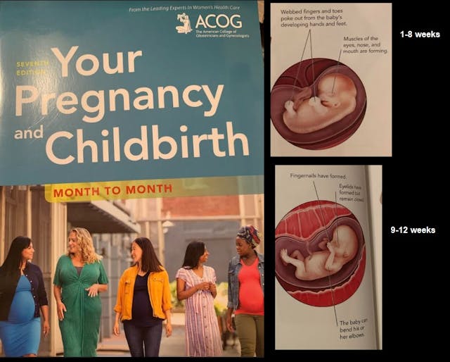 ACOG Your Pregnancy and Childbirth 7th edition fetal development 1-12 weeks Image: ACOG Your Pregnancy and Childbirth 7th edition fetal development 1-12 weeks