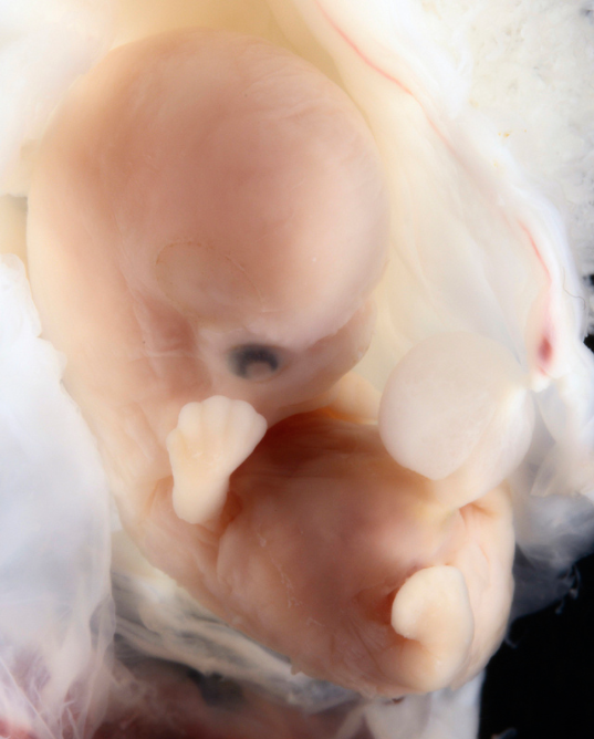 6-7 weeks post-fertilization