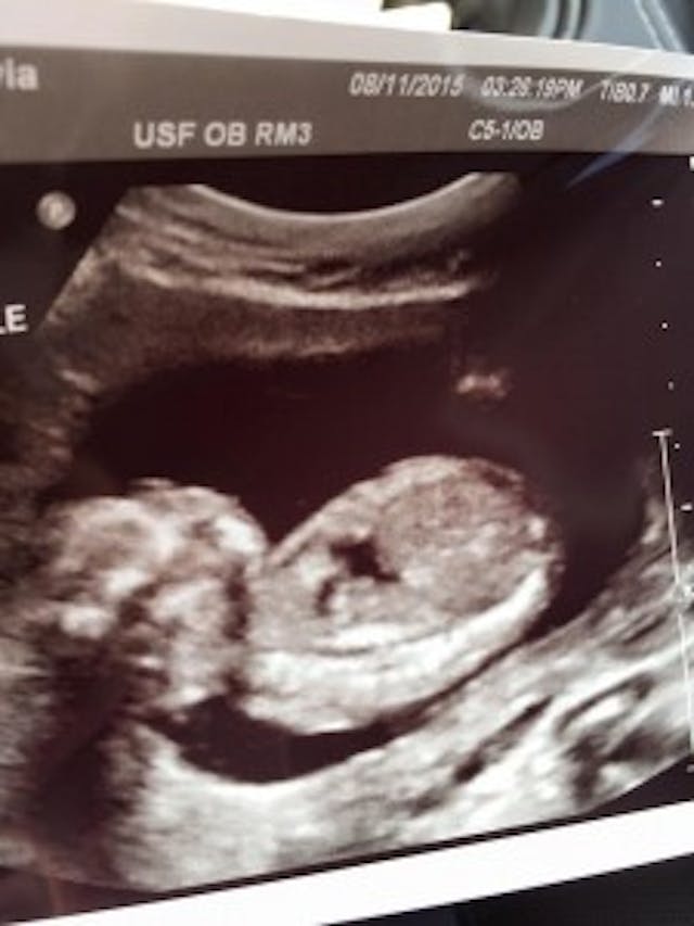 Layla Sky in her ultrasound – via Facebook. Layla Sky in her ultrasound via Facebook.